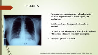 PLEURA
• Es una membrana serosa que rodea el pulmón y
reviste la superficie costal, el diafragma y el
mediastino.
• Está formada por dos capas, la visceral y la
parietal.
• La visceral está adherida a la superficie del pulmón
y la parietal a la pared torácica y diafragma.
• El espacio pleural es virtual.
 