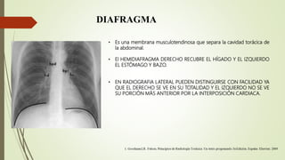 DIAFRAGMA
• Es una membrana musculotendinosa que separa la cavidad torácica de
la abdominal.
• El HEMIDIAFRAGMA DERECHO RECUBRE EL HÍGADO Y EL IZQUIERDO
EL ESTÓMAGO Y BAZO.
• EN RADIOGRAFIA LATERAL PUEDEN DISTINGUIRSE CON FACILIDAD YA
QUE EL DERECHO SE VE EN SU TOTALIDAD Y EL IZQUIERDO NO SE VE
SU PORCIÓN MÁS ANTERIOR POR LA INTERPOSICIÓN CARDIACA.
 