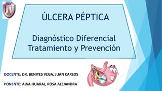 ÚLCERA PÉPTICA
Diagnóstico Diferencial
Tratamiento y Prevención
DOCENTE: DR. BENITES VEGA, JUAN CARLOS
PONENTE: ALVA HUARAJ, ROSA ALEJANDRA
 