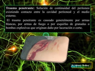 Trauma penetrante: Solución de continuidad del peritoneo
existiendo contacto entre la cavidad peritoneal y el medio
externo.
El trauma penetrante es causado generalmente por armas
blancas, por armas de fuego o por esquirlas de granadas o
bombas explosivas que originan daño por laceración o corte.
 