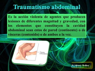 Es la acción violenta de agentes que producen
lesiones de diferentes magnitud y gravedad, con
los elementos que constituyen la cavidad
abdominal sean estos de pared (continente) o de
vísceras (contenido) o de ambos a la vez.
 