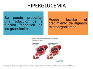 HIPERGLUCEMIA
Se puede presentar
una reducción de la
función fagocítica de
los granulocitos
Puede facilitar el
crecimiento de algunos
microorganismos
Vargas Miguel. Diabetes tipo I y enfermedad periodontal. Especialista en Periodoncia y Medicina Oral, Universidad El Bosque
 