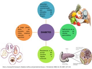 DIABETES
Desorden
metabólico
caracterizado
por niveles
elevados de
glucosa en
sangre.
Deficiencia de la
secreción de
células B-
pancreática
Resistencia a la
acción de
insulina en
hígado o
musculo
A largo plazo:
daño en
corazón, ojos,
riñón, sistema
vascular y
nervioso
Brian L, Ocampo M, Ocampo G. Diabetes mellitus and periodontal disease. J. Periodontol. 2000, Vol. 44, 2007, 127–153
 