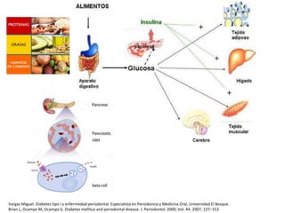 Vargas Miguel. Diabetes tipo I y enfermedad periodontal. Especialista en Periodoncia y Medicina Oral, Universidad El Bosque.
Brian L, Ocampo M, Ocampo G. Diabetes mellitus and periodontal disease. J. Periodontol. 2000, Vol. 44, 2007, 127–153
 