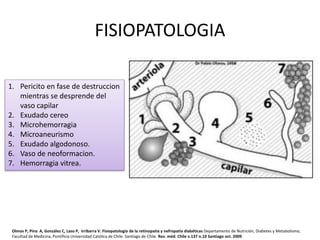 FISIOPATOLOGIA
1. Pericito en fase de destruccion
mientras se desprende del
vaso capilar
2. Exudado cereo
3. Microhemorragia
4. Microaneurismo
5. Exudado algodonoso.
6. Vaso de neoformacion.
7. Hemorragia vitrea.
Olmos P, Pino A, González C, Laso P, Irribarra V. Fisiopatología de la retinopatía y nefropatía diabéticas Departamento de Nutrición, Diabetes y Metabolismo,
Facultad de Medicina, Pontificia Universidad Católica de Chile. Santiago de Chile. Rev. méd. Chile v.137 n.10 Santiago oct. 2009
 