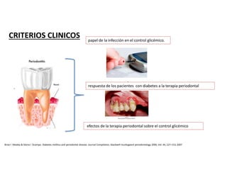 .
.
CRITERIOS CLINICOS papel de la infección en el control glicémico.
respuesta de los pacientes con diabetes a la terapia periodontal
efectos de la terapia periodontal sobre el control glicémico
Brian l. Mealey & Gloria l. Ocampo. Diabetes mellitus and periodontal disease. Journal Compilation, blackwell munksgaard periodontology 2000, Vol. 44, 127–153, 2007
 