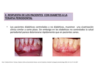 • Los pacientes diabéticos controlados y no diabéticos, muestran una cicatrización
clínica similar a corto plazo. Sin embargo en los diabéticos no controlados la salud
periodontal parece deteriorarse rápidamente que en pacientes sanos.
2. RESPUESTA DE LOS PACIENTES CON DIABETES A LA
TERAPIA PERIODONTAL
Brian l. Mealey & Gloria l. Ocampo. Diabetes mellitus and periodontal disease. Journal Compilation, blackwell munksgaard periodontology 2000, Vol. 44, 127–153, 2007
 