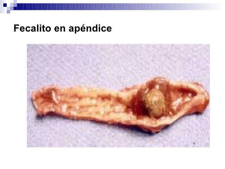 Forma mas rapida de bajar de peso sin dieta rico agua, fibra Personas forma mas rapida de bajar de peso sin dieta decir aporta