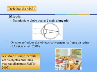 Defeitos da visão

     Miopia
        Na miopia o globo ocular é mais alongado;




      Os raios refletidos dos objetos convergem na frente da retina
      (PASSOS et al., 2008)


A visão é distante, permite
ver os objetos próximos,
mas não distantes (SMITH,
2007).
 
