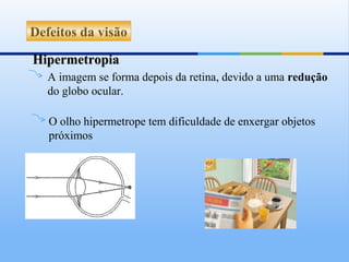 Defeitos da visão

Hipermetropia
   A imagem se forma depois da retina, devido a uma redução
   do globo ocular.

   O olho hipermetrope tem dificuldade de enxergar objetos
   próximos
 
