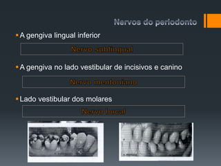 A gengiva lingual inferior
A gengiva no lado vestibular de incisivos e canino
Lado vestibular dos molares
 