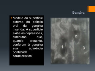 Modelo da superfície
externa do epitélio
oral da gengiva
inserida. A superfície
exibe as depressões,
diminutas que,
quando presente,
conferem à gengiva
sua aparência
pontilhada
característica
 