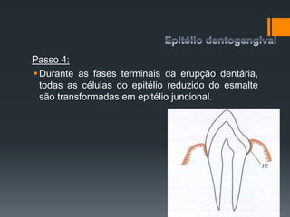 Passo 4:
Durante as fases terminais da erupção dentária,
todas as células do epitélio reduzido do esmalte
são transformadas em epitélio juncional.
 