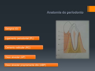 Osso alveolar (AP)
Ligamento periodontal (PL)
Gengiva (G)
Cemento radicular (RC)
Osso alveolar propriamente dito (ABP)
 
