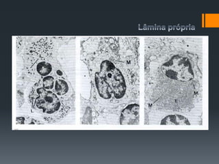 Lâmina própria
Células inflamatórias:
 São representadas como os granulócitos neutrófilos,
linfócitos e plasmócitos e têm função na resposta de defesa.
 Fig 1.40
 