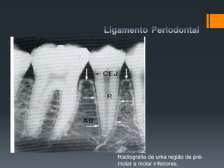 Radiografia de uma região de pré-
molar e molar inferiores.
 