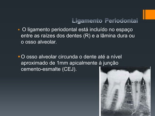  O ligamento periodontal está incluído no espaço
entre as raízes dos dentes (R) e a lâmina dura ou
o osso alveolar.
O osso alveolar circunda o dente até a nível
aproximado de 1mm apicalmente à junção
cemento-esmalte (CEJ).
 