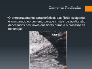 O entrecruzamento característicos das fibras colágenas
é mascarado no cemento porque cristais de apatita são
depositados nos feixes das fibras durante o processo de
mineração.
 