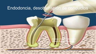 Endodoncia, desobturación de conductos
Docente: Dra Katina Marinkovic
Alumno: Consuelo Fernández
 