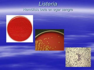 ListeriaHemólisis beta en agar sangre 