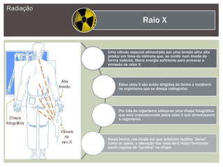 Radiação
Raio X
Uma válvula especial alimentada por uma tensão ultra alta
produz um feixe de elétrons que, ao incidir num ânodo de
forma violenta, libera energia suficiente para provocar a
emissão de raios X.
Estes raios X são então dirigidos de forma a incidirem
no organismo que se deseja radiografar.
Por trás do organismo coloca-se uma chapa fotográfica
que será impressionada pelos raios X que atravessarem
o organismo.
Desta forma, nos locais em que existirem tecidos "duros"
como os ossos, a absorção dos raios será maior formando
assim regiões de "sombra" na chapa
 