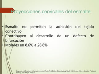 • Esmalte no permiten la adhesión del tejido
conectivo
• Contribuyen al desarrollo de un defecto de
bifurcación
• Molares en 8.6% a 28.6%
Diagnosis and Treatment of Furcation-Involved Teeth, First Edition. Edited by Luigi Nibali. © 2018 John Wiley & Sons Ltd. Published
2018 by John Wiley & Sons Ltd.
Proyecciones cervicales del esmalte
 
