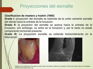 Clasificacion de masters y hoskin (1965)
Grado I: proyección del esmalte se extiende de la unión cemento esmalte
del diente hacia la entrada de la furcacion.
Grado II: la proyecion del esmalte se acerca hacia la entrada de la
furcacion, sim embargo, no entra en la furcacion y, por lo tanto no existe
componente horizontal presente.
Grado III: La proyección esmalte se extiende horizontalmente en la
bifurcación
Diagnosis and Treatment of Furcation-Involved Teeth, First Edition. Edited by Luigi Nibali. © 2018 John Wiley & Sons Ltd. Published
2018 by John Wiley & Sons Ltd.
Proyecciones del esmalte
 