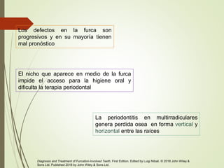 Los defectos en la furca son
progresivos y en su mayoría tienen
mal pronóstico
Diagnosis and Treatment of Furcation-Involved Teeth, First Edition. Edited by Luigi Nibali. © 2018 John Wiley &
Sons Ltd. Published 2018 by John Wiley & Sons Ltd.
La periodontitis en multirradiculares
genera perdida osea en forma vertical y
horizontal entre las raíces
El nicho que aparece en medio de la furca
impide el acceso para la higiene oral y
dificulta la terapia periodontal
 
