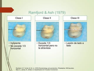 Ramfjord & Ash (1979)
• Incipiente
• No excede 1/3
horizontal
Clase I
• Excede 1/3
horizontal pero no
la atraviesa
Clase II
• Lesión de lado a
lado
Clase III
Ramfjord, S. P. & Ash, M. M. Jr. (1979) Periodontology and periodontics. Philadelphia: WB Saunders.
Mani, A., James, R., & Mani, S. Classifications for Furcation Involvement.
 