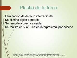 Lindhe, J., Karring, T., & Lang, N. P. (2009). Periodontologia clinica e implantologia
odontologica/Clinical Periodontology and Implant Dentistry (Vol. 1). Ed. Médica Panamericana.
• Eliminación de defecto interradicular
• Se elimina tejido dentario
• Se remodela cresta alveolar
• Se realiza en V o L, no en interproximal por acceso
Plastia de la furca
 