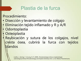 Lindhe, J., Karring, T., & Lang, N. P. (2009). Periodontologia clinica e implantologia
odontologica/Clinical Periodontology and Implant Dentistry (Vol. 1). Ed. Médica Panamericana.
Procedimiento:
• Disección y levantamiento de colgajo
• Eliminación tejido inflamado y R y A/R
• Odontoplastia
• Osteoplastia
• Reubicación y sutura de los colgajos, nivel
cresta ósea, cubrirá la furca con tejidos
blandos
Plastia de la furca
 