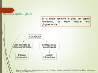 Tecnica quirurgica
Diagnosis and Treatment of Furcation-Involved Teeth, First Edition. Edited by Luigi Nibali. © 2018 John Wiley & Sons Ltd. Published
2018 by John Wiley & Sons Ltd.
Gran cantidad de
encía queratinizada
Incisión
festoneada
Limitada encía
queratinizada
Incisión
intrasulcular
Si la encía obstruye el paso del cepillo
interdental, se debe realizar una
gingivectomía
COLGAJO
 