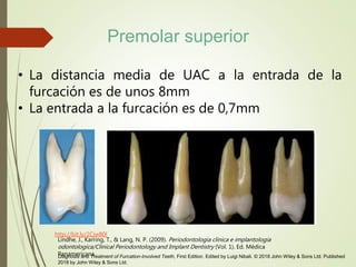 • La distancia media de UAC a la entrada de la
furcación es de unos 8mm
• La entrada a la furcación es de 0,7mm
http://bit.ly/2CjwB0l
Lindhe, J., Karring, T., & Lang, N. P. (2009). Periodontologia clinica e implantologia
odontologica/Clinical Periodontology and Implant Dentistry (Vol. 1). Ed. Médica
Panamericana.Diagnosis and Treatment of Furcation-Involved Teeth, First Edition. Edited by Luigi Nibali. © 2018 John Wiley & Sons Ltd. Published
2018 by John Wiley & Sons Ltd.
Premolar superior
 