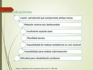 Contraindicaciones
Lesión periodontal que compromete ambas raíces
Relación corona-raíz desfavorable
Insuficiente soporte óseo
Movilidad severa
Imposibilidad de realizar endodoncia en raíz residual
Imposibilidad para realizar odontosección
Dificultad para rehabilitación protésica
Quispe L. Radicectomia. Rev Actualización Clinica. 2012; 21: 1095-1099
 