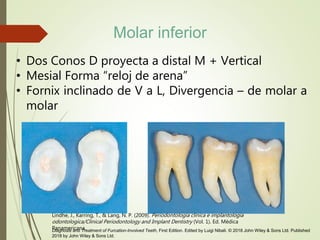 • Dos Conos D proyecta a distal M + Vertical
• Mesial Forma “reloj de arena”
• Fornix inclinado de V a L, Divergencia – de molar a
molar
Lindhe, J., Karring, T., & Lang, N. P. (2009). Periodontologia clinica e implantologia
odontologica/Clinical Periodontology and Implant Dentistry (Vol. 1). Ed. Médica
Panamericana.Diagnosis and Treatment of Furcation-Involved Teeth, First Edition. Edited by Luigi Nibali. © 2018 John Wiley & Sons Ltd. Published
2018 by John Wiley & Sons Ltd.
Molar inferior
 