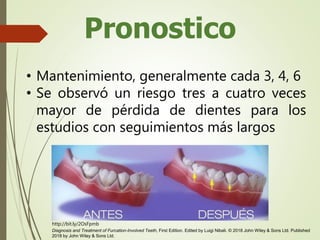 Pronostico
• Mantenimiento, generalmente cada 3, 4, 6
• Se observó un riesgo tres a cuatro veces
mayor de pérdida de dientes para los
estudios con seguimientos más largos
Diagnosis and Treatment of Furcation-Involved Teeth, First Edition. Edited by Luigi Nibali. © 2018 John Wiley & Sons Ltd. Published
2018 by John Wiley & Sons Ltd.
http://bit.ly/2OsFpmb
 