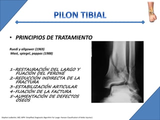FRACTURAS DE TOBILLO | PPTX