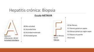 Seminario de Hepatitis, generalidades... | PPTX