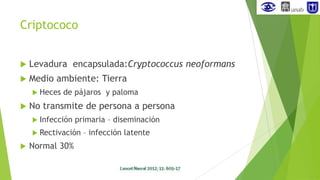 SEMINARIO Infecciones SNC 2013