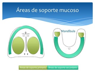Áreas de soporte mucoso
Maxilar Mandíbula
Áreas de soporte primario Áreas de soporte secundario
 