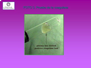 FOTO 3. Prueba de la coagulasa 
 