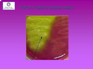 FOTO 4. Prueba de Chapman positivo 
 