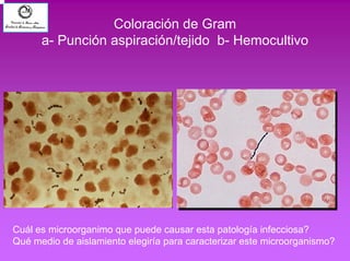 Coloración de Gram 
a- Punción aspiración/tejido b- Hemocultivo 
Cuál es microorganimo que puede causar esta patología infecciosa? 
Qué medio de aislamiento elegiría para caracterizar este microorganismo? 
 