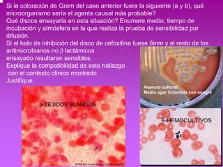 Si la coloración de Gram del caso anterior fuera la siguiente (a y b), qué 
microorganismo sería el agente causal más probable? 
Qué discos ensayaría en esta situación? Enumere medio, tiempo de 
incubación y atmósfera en la que realiza la prueba de sensibilidad por 
difusión. 
Si el halo de inhibición del disco de cefoxitina fuese 6mm y el resto de los 
antimicrobianos no β lactámicos 
ensayado resultaran sensibles. 
Explique la compatibilidad de este hallazgo 
con el contexto clínico mostrado. 
Justifique. 
a-TEJIDOS BLANDOS 
Aspecto cultural. 
Medio agar Columbia con sangre 
B-HEMOCULTIVOS 
 