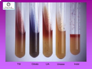 TSI Citrato LIA Ureasa Indol 
 