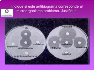 Indique si este antibiograma corresponde al 
microorganismo problema. Justifique. 
ampicilina 
cefalotina cefoxitina 
TMS 
ciprofloxacina 
ampicilina-sulbactama 
colistina 
ceftazidima 
cefepima 
cefotaxima 
 