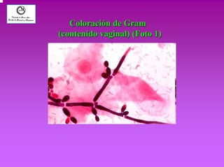 Coloración de Gram 
(contenido vaginal) (Foto 1) 
 