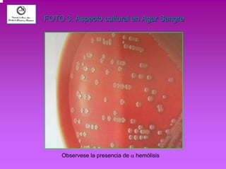 FOTO 3. Aspecto cultural en Agar Sangre 
Observese la presencia de α hemólisis 
 