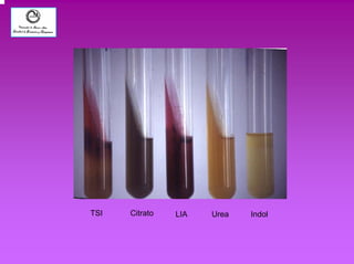 TSI Citrato LIA Urea Indol 
 