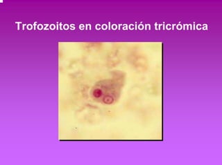 Trofozoitos en coloración tricrómica 
 